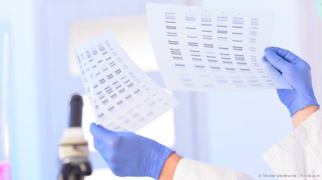 DNA-Test: Besteht ein genetisches Risiko, an Parodontitis zu erkranken? DNA-Test: Besteht ein genetisches Risiko, an Parodontitis zu erkranken?