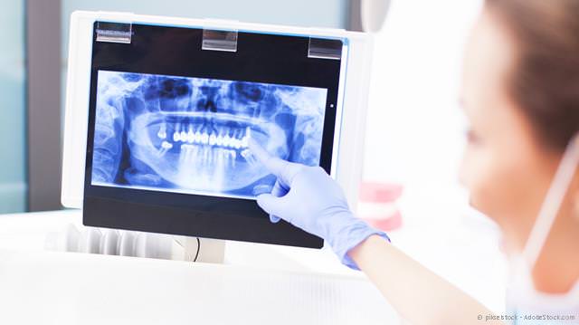 Röntgendiagnostik zur Kontrolle der Kieferknochen Röntgendiagnostik zur Kontrolle der Kieferknochen