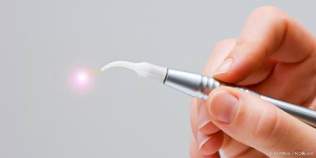 Dental-Laser: Schonende Parodontitis-Behandlung Dental-Laser: Schonende Parodontitis-Behandlung