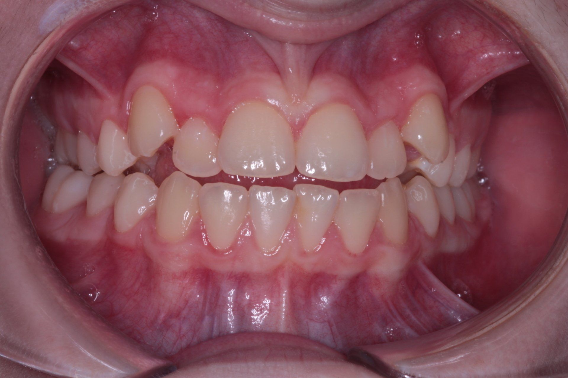 Teeth 1