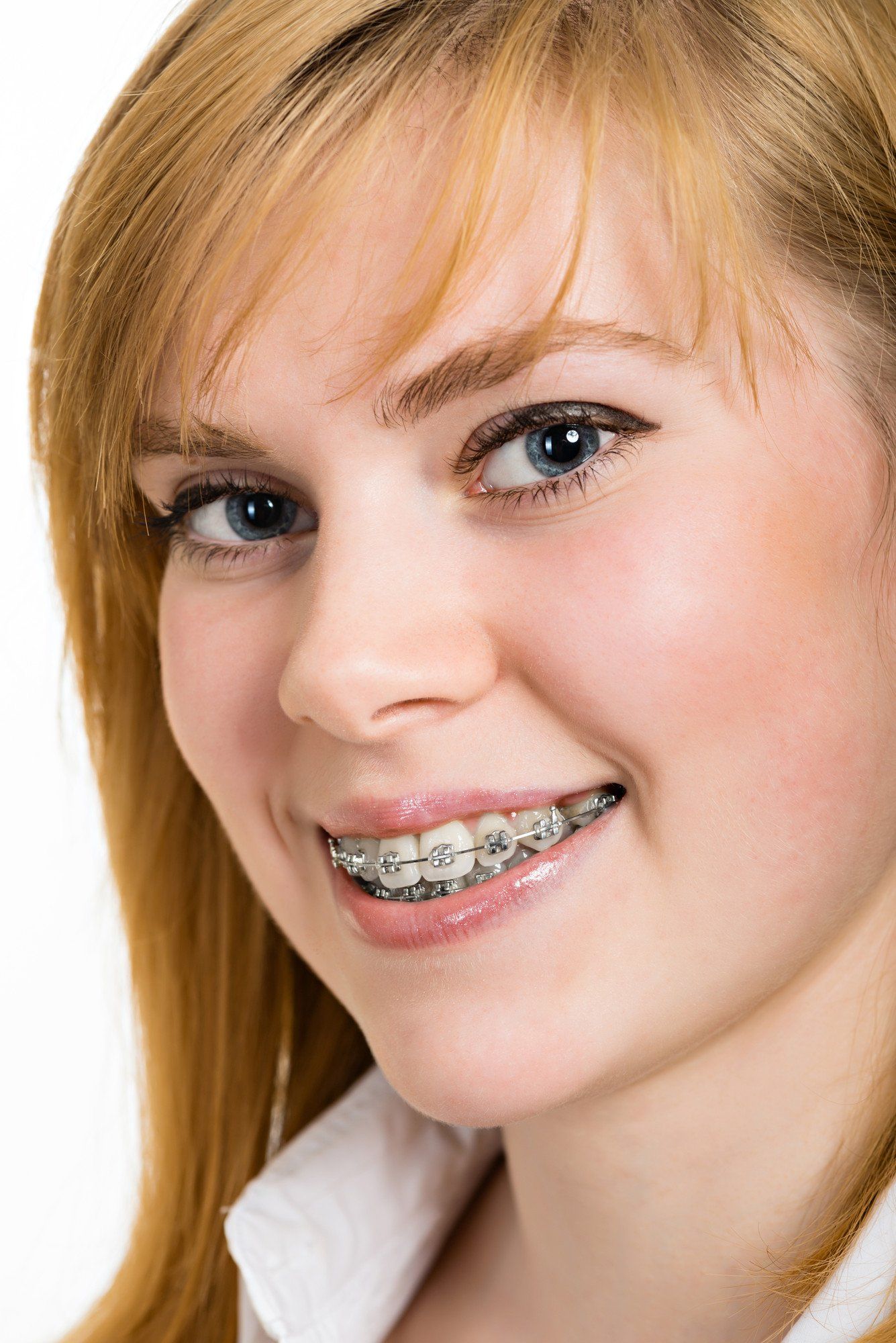 Orthodontics
