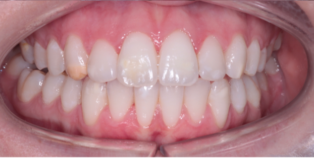 Teeth 6