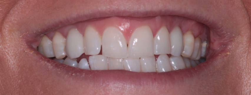 Teeth 8