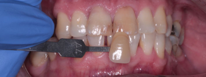 Teeth 3