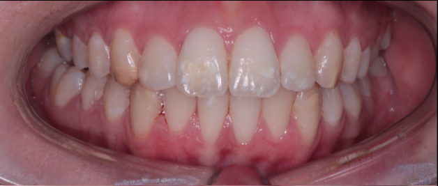Teeth 5