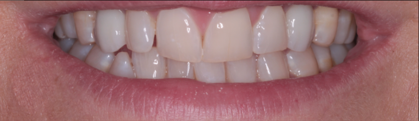 Teeth 7