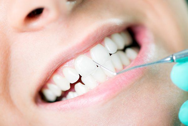 Mouth Close Up with White Teeth