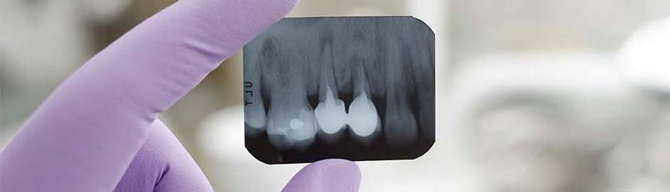dental xray at garibaldi crossing dental