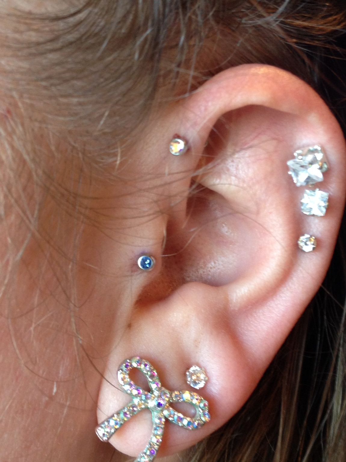 Forward helix