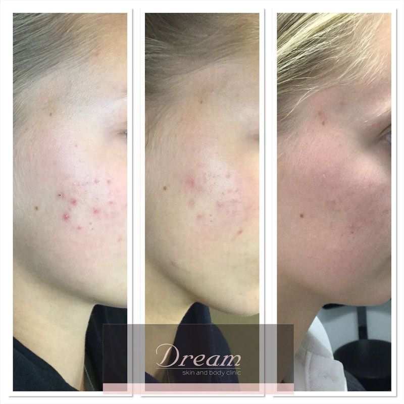 before and after
