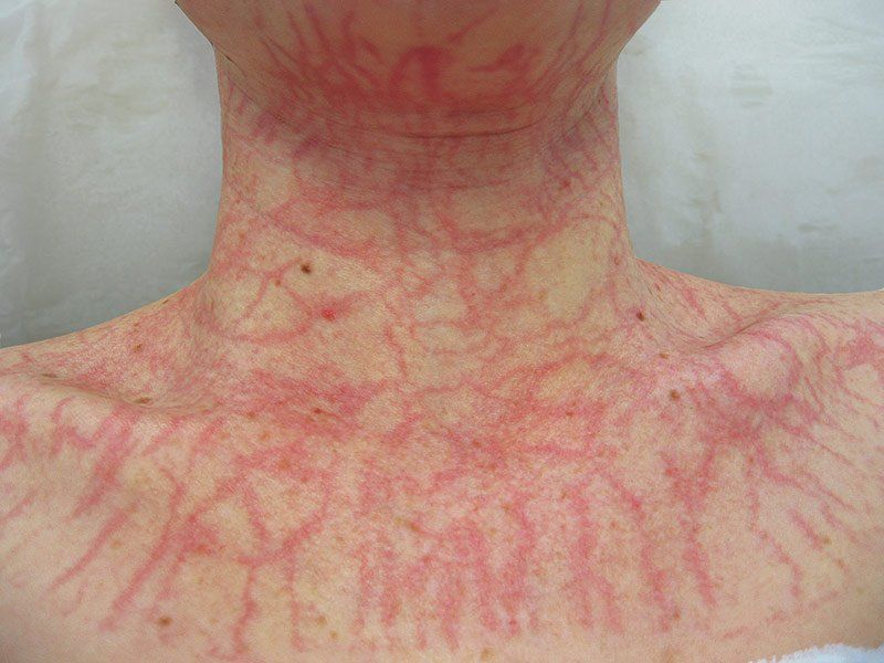 dmk enzyme therapy plasmatic effect