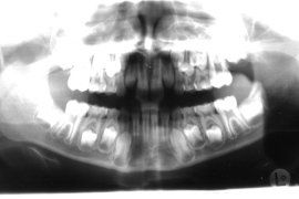 Radiografia di ortognatodonzia