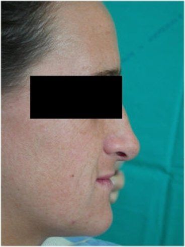 Riabilitazioni estetiche
