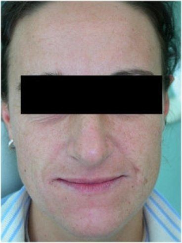 Riabilitazioni estetiche