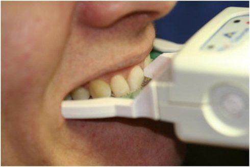 Riabilitazioni estetiche