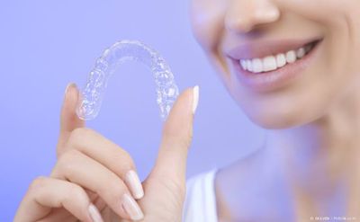 Aligner: Transparente Folie für die unauffällige Zahnregulierung Aligner: Transparente Folie für die unauffällige Zahnregulierung