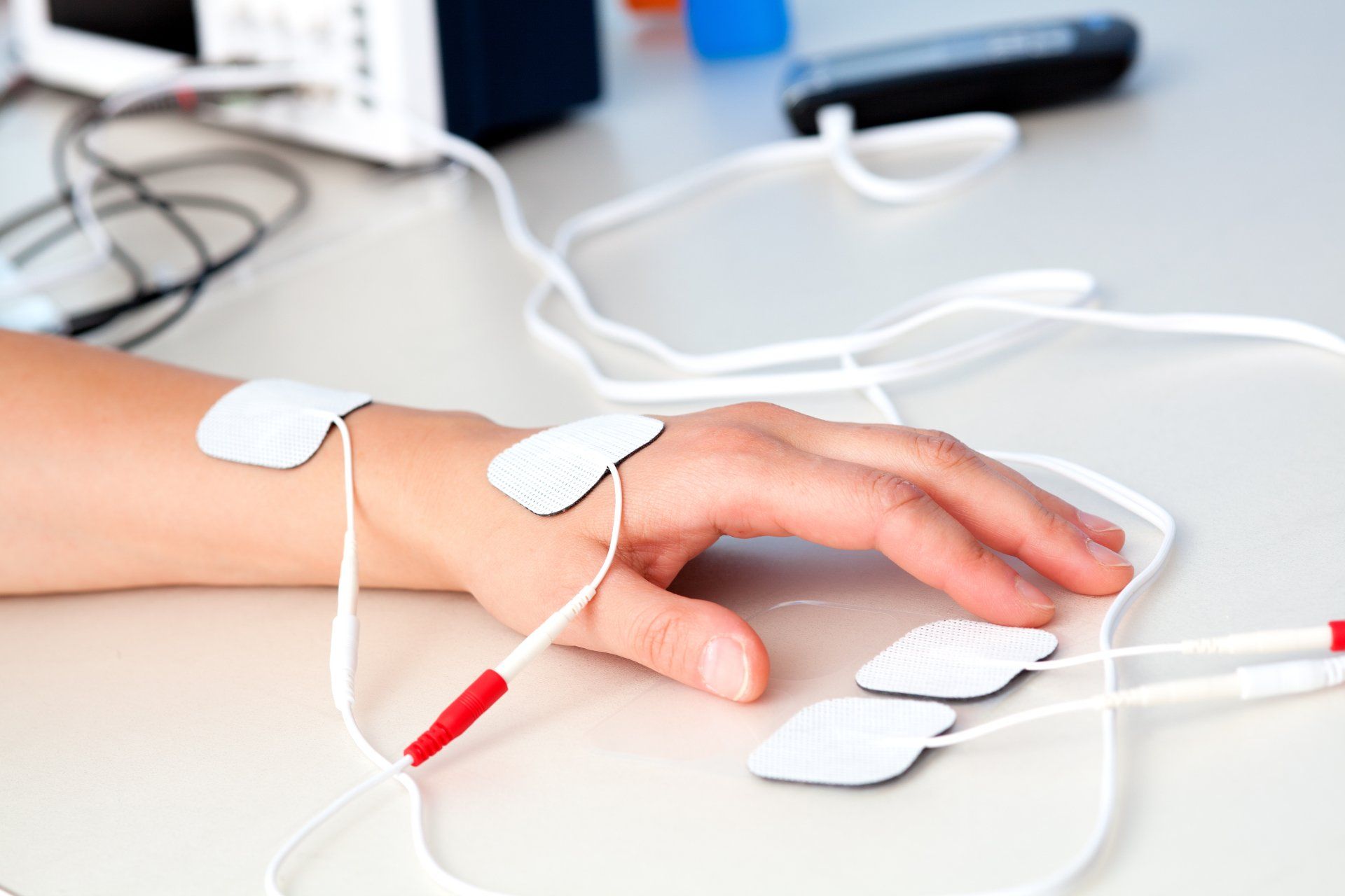 A close up of a person 's arm with electrodes on it