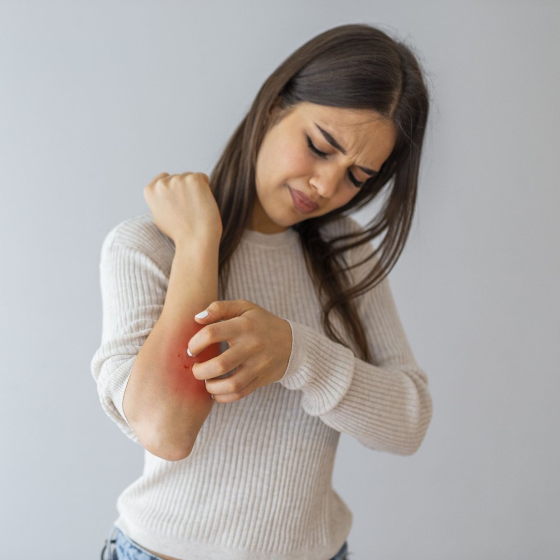 Woman in a white sweater rubbing a red, irritated elbow against a plain gray background