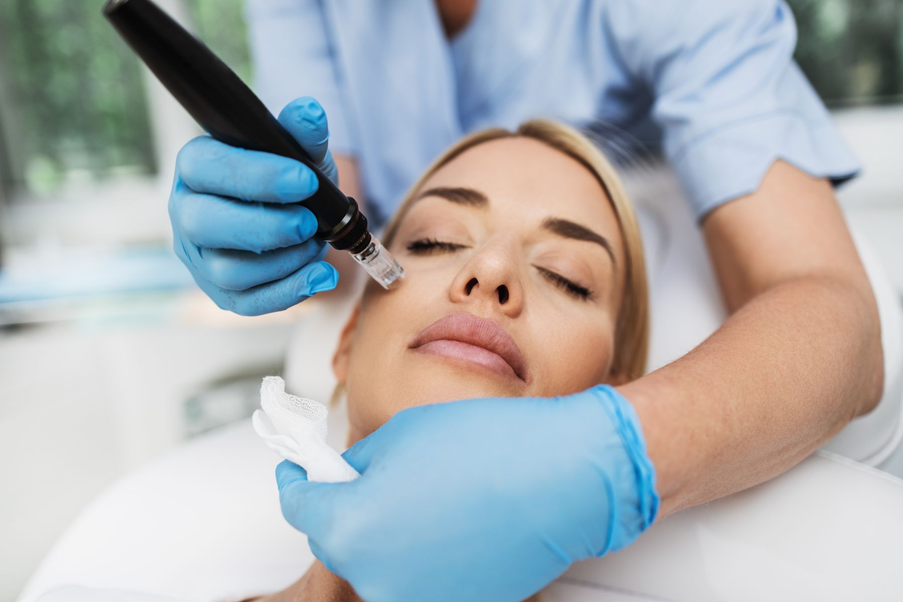 microneedling on woman's face