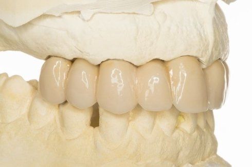 'estetica dentale, parodontologia, protesi fisse