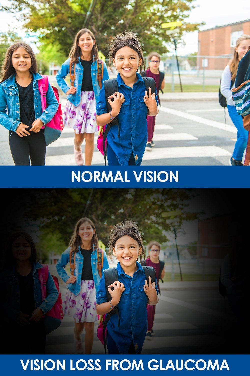 Glaucoma Vision Difference — Big Rapids, MI — Crew & Boss Eye Associates Glaucoma Vision Difference — Big Rapids, MI — Crew & Boss Eye Associates