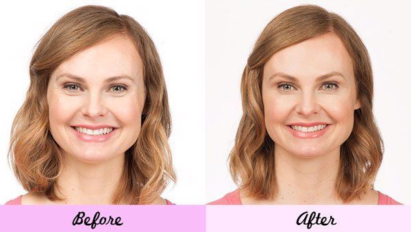 Pretty Lady Before and After Botox — Big Rapids, MI — Crew & Boss Eye Associates Pretty Lady Before and After Botox — Big Rapids, MI — Crew & Boss Eye Associates