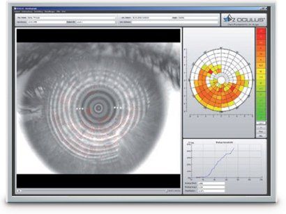 Eye scan analysis screen with grayscale eye image, colored map, and graph dashboard