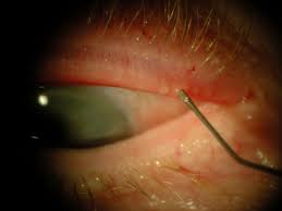 Maskin Probing