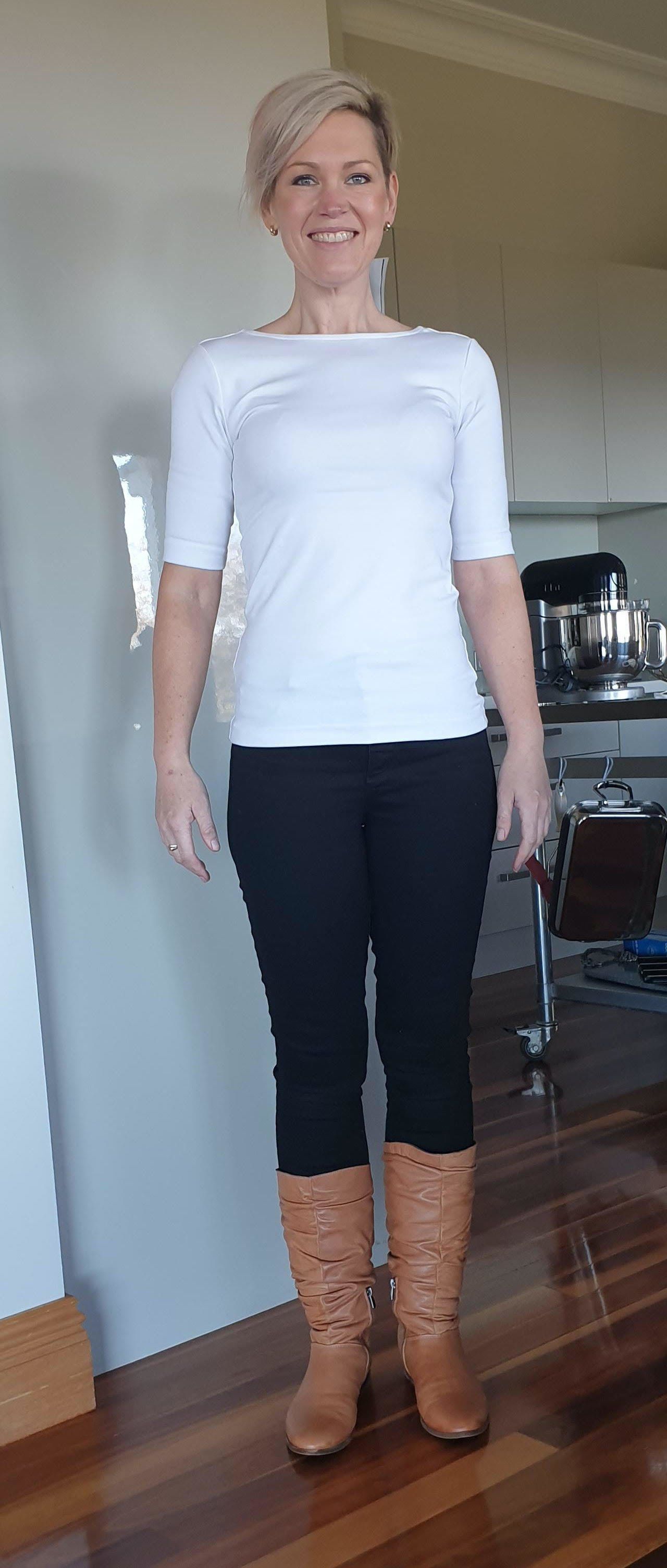 Patient Sarah after surgery