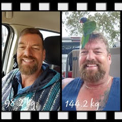Patient Darren Before and After weight loss
