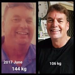 Patient Darren Before and After weight loss