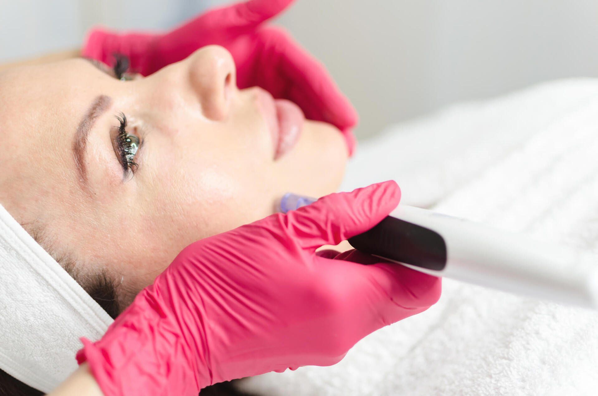 microneedling dermatude kosmetik uster