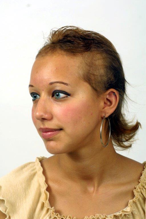Woman Hair Loss Control — Melissa Before in Spokane, WA