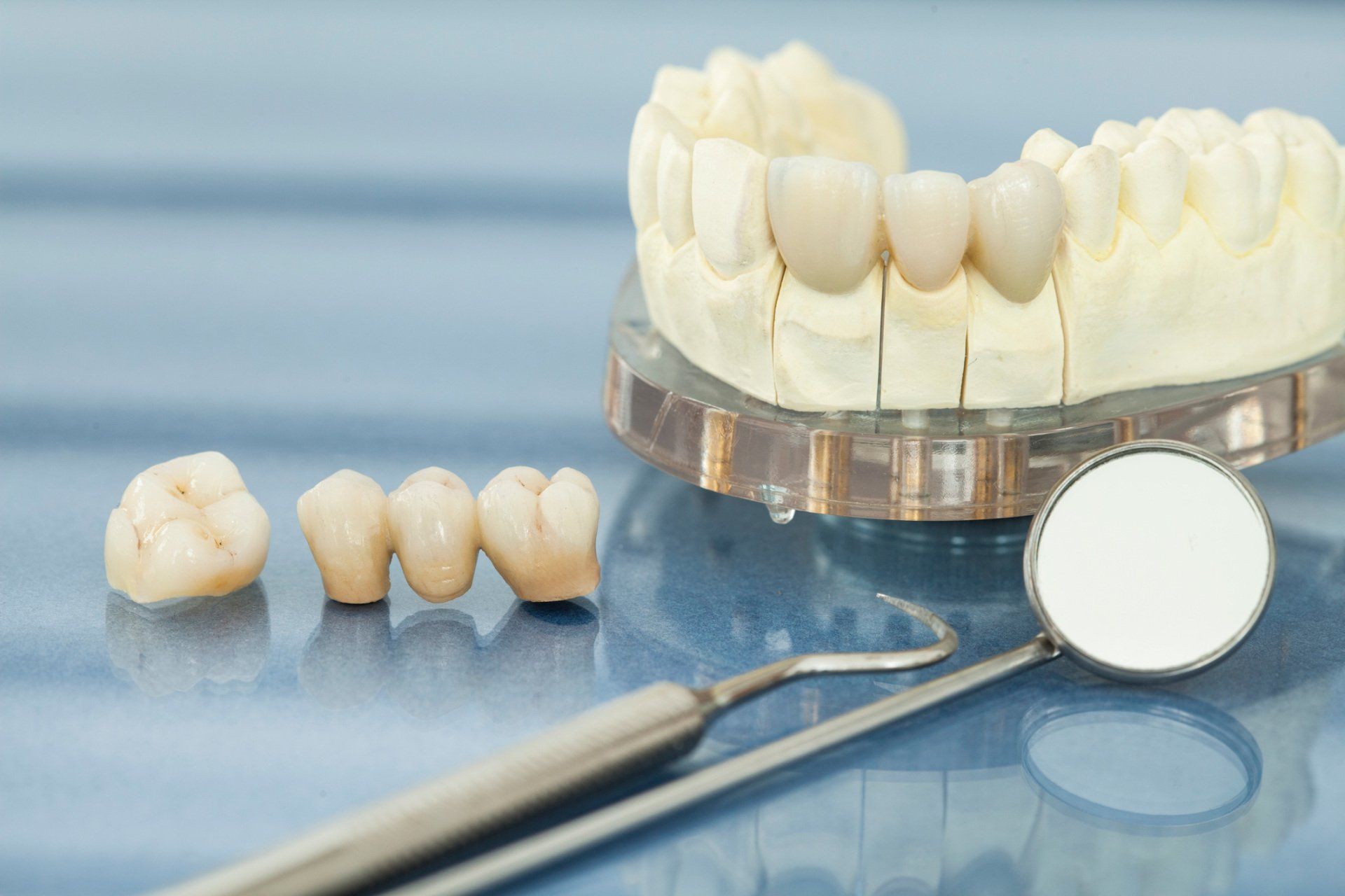Crowns — Visual Of Dental Health Care in Henderson, NC Crowns — Visual Of Dental Health Care in Henderson, NC