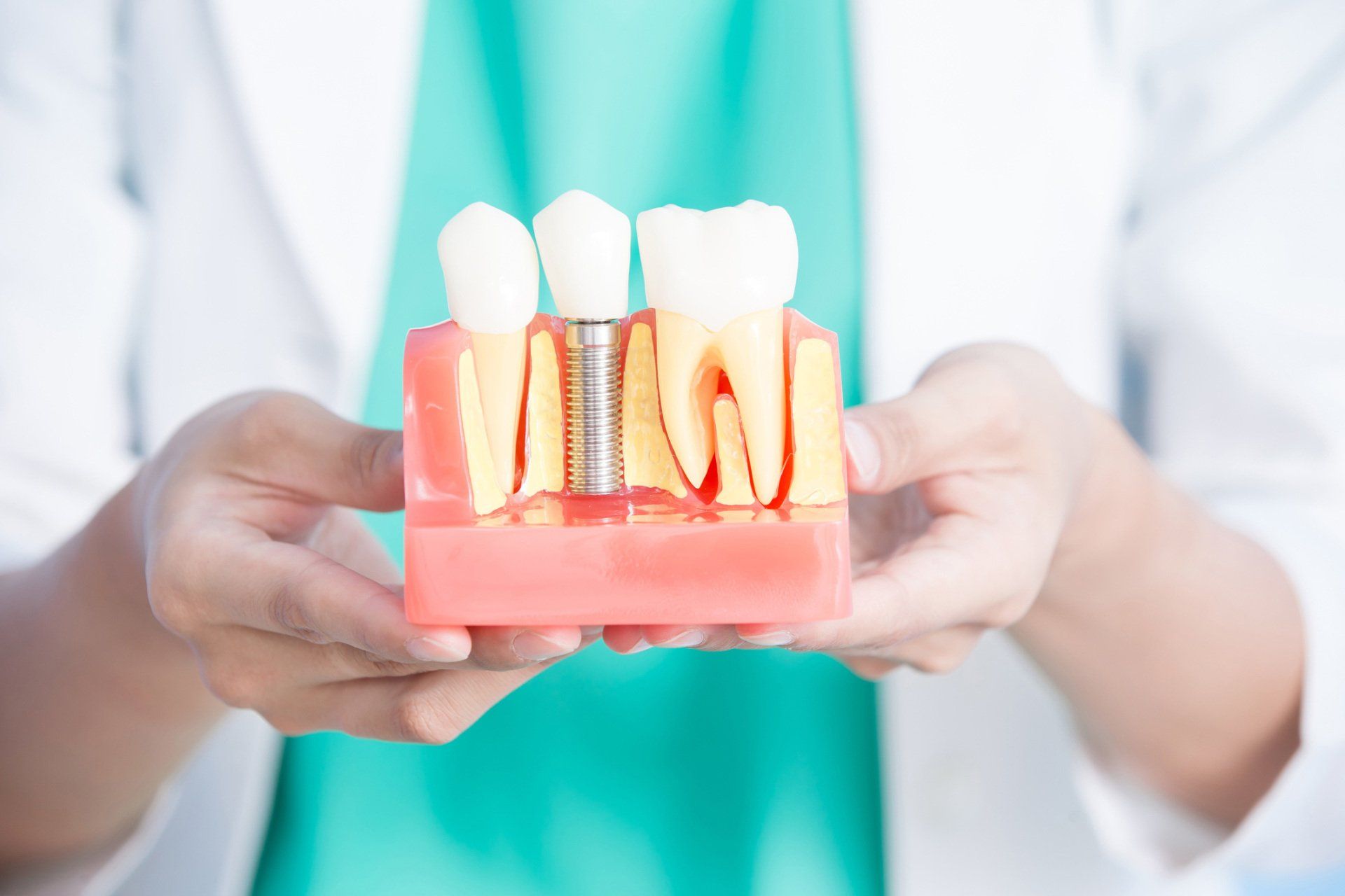 Implant — Woman Dentist Take Implant Tooth in Henderson, NC Implant — Woman Dentist Take Implant Tooth in Henderson, NC
