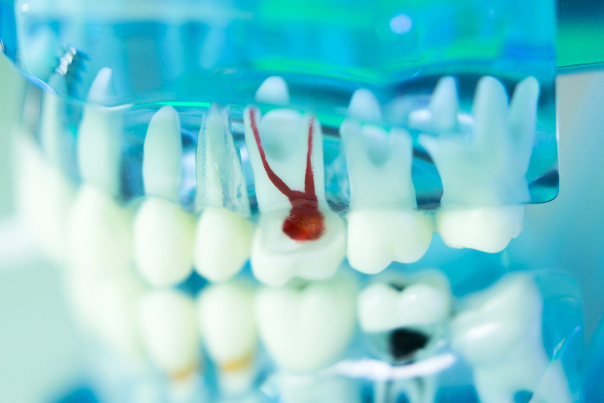 Root — Dental Teeth Teaching Model in Henderson, NC Root — Dental Teeth Teaching Model in Henderson, NC