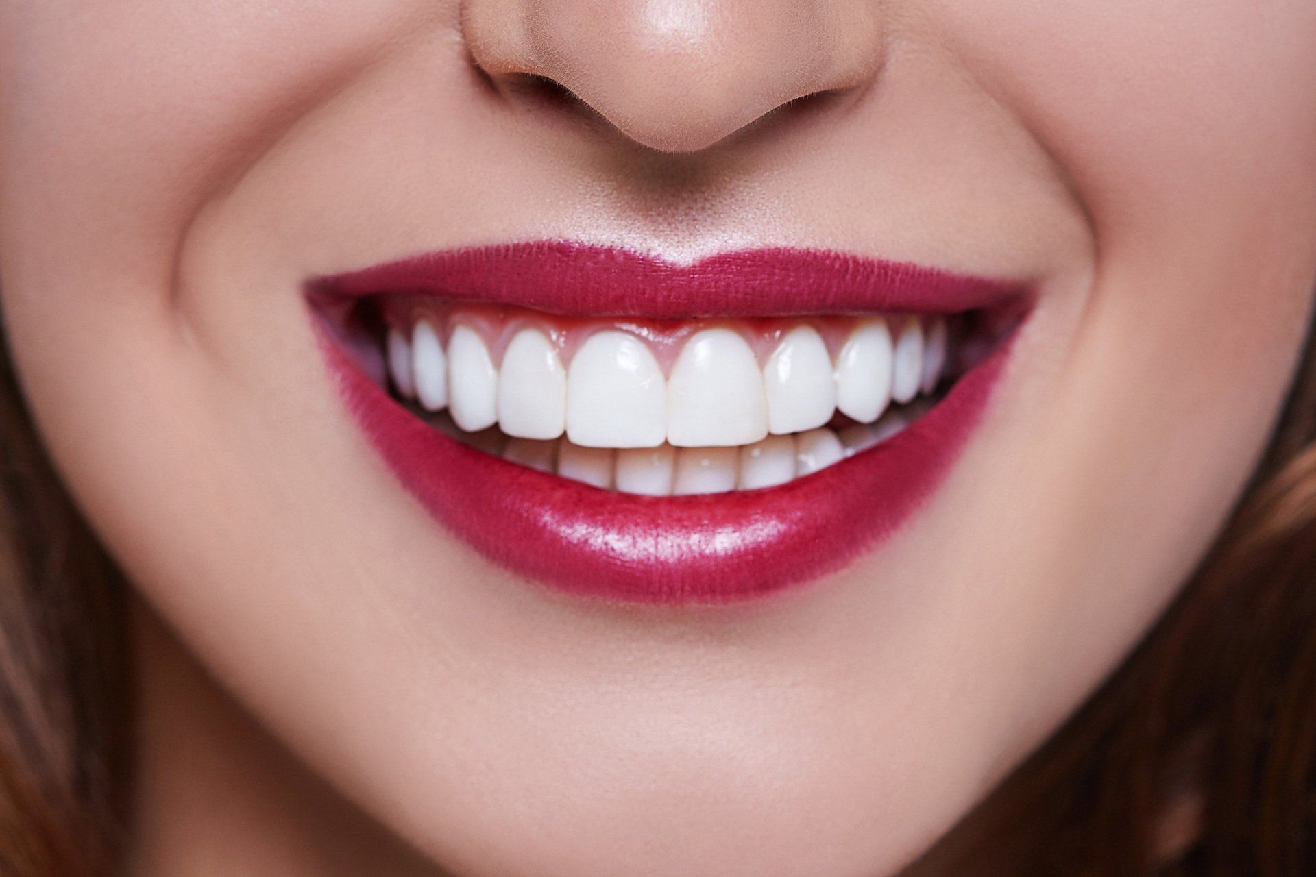 Veneers — Woman Smiling With Beautiful Teeth in Henderson, NC Veneers — Woman Smiling With Beautiful Teeth in Henderson, NC