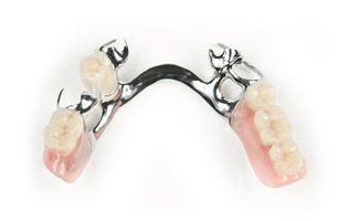 Denture fixtures