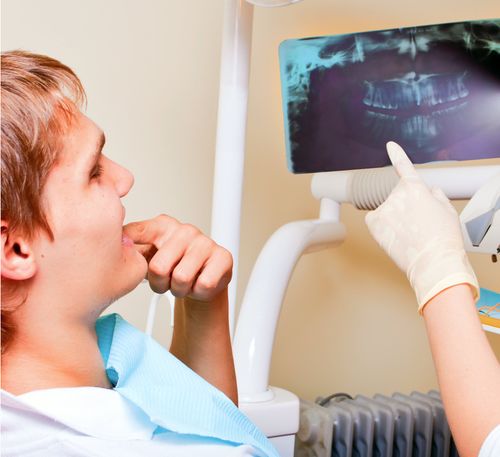 Root Canal - Special Smiles, San Diego, Imperial Beach