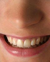 - Special Smiles, San Diego, Imperial Beach