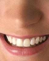 - Special Smiles, San Diego, Imperial Beach
