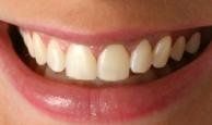- Special Smiles, San Diego, Imperial Beach