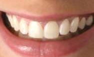- Special Smiles, San Diego, Imperial Beach