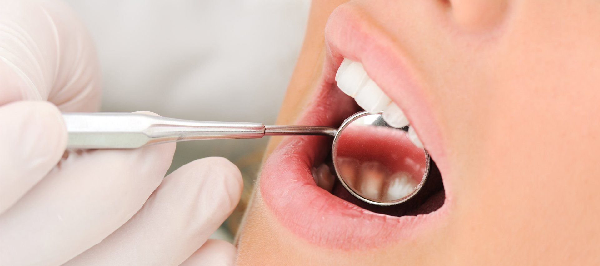Avoiding Tooth Decay