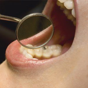 Dental treatments