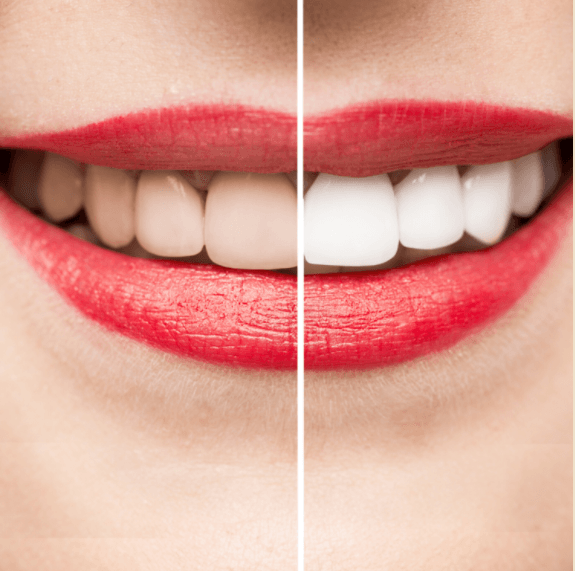 Howland Family Dental, cosmetic dental options
