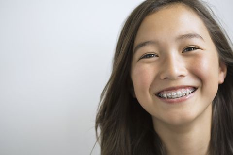 Braces — Newport News, VA — Jefferson Family Dentistry