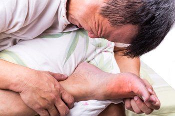 Gout — Man Suffering From Gout in Orlando, FL Gout — Man Suffering From Gout in Orlando, FL