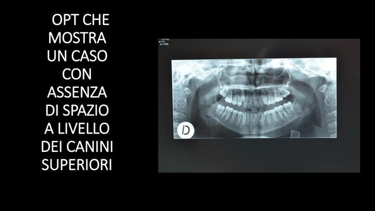 radiografia