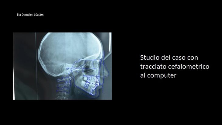 radiografia dentale